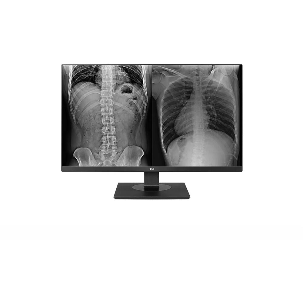 LG 27HJ713C-B – 27" 3840 x 2160 IPS Panel Medical Monitor Medical Displays LG Electronics